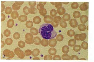 Glóbulos Rojos, Eritrocitos o Hematíes: Transporte de gases (O 2 y CO 2 ) Glóbulos blancos o Leucocitos: