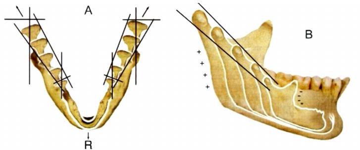 N 3: Áreas de aposición y reabsorción de la mandíbula (19) La mandíbula tiene un trayecto de crecimiento hacia atrás y arriba, sin embargo su desplazamiento se hace hacia delante y hacia abajo. (Fig.