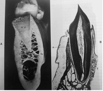 Fig. N 9. Hueso alveolar. A: Muestra desecada de hueso de la mandíbula. Hueso alveolar (HA), esponjoso (HE) y tabla cortical externa (Ex). B: Incisivo inferior de adulto.