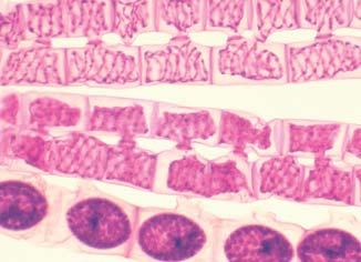 l. / Marchantia male genital organ, l.s. 30493019 Órgano reproductor femenino de Marchantia, s.l. / Marchantia female genital organ, l.s. 30493020 Hoja de musgo, m.e. / Moss leaf, w.m. 30493021 Musgo, m.