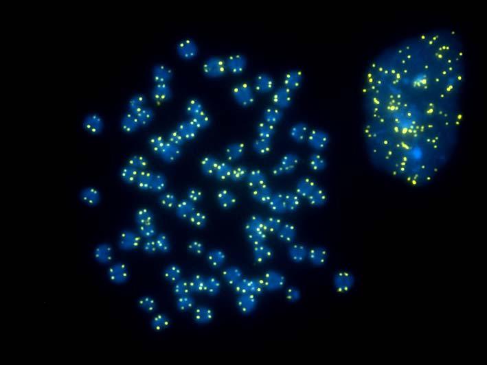Detección de telomeros en metafases