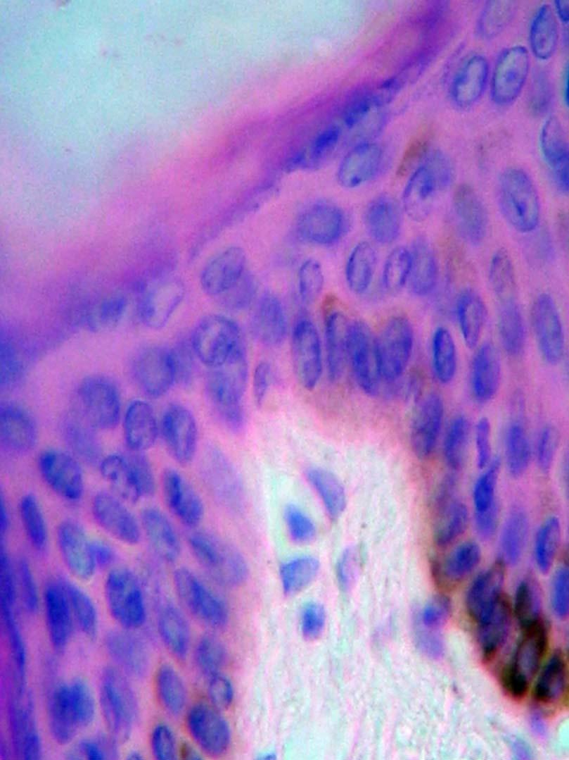 40x H/E Las células del estrato granuloso