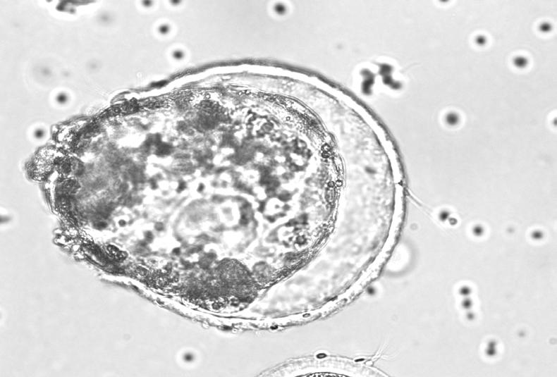 Embriones in vitro Semen sexado Holstein 945 blastocistos producidos in vitro Receptoras Hereford DIB 0,5 g EB 2 mg ECP 0,5 mg ecg 400 UI PGF2α 500 µg