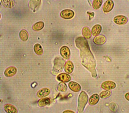 Pleurocistidios y queilocistidios: aparentemente queilocistidios, 7 x 15 µm, clavados, pared lisa, inamiloides. Corteza: celular o cistodérmica.