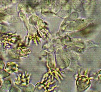 Basidios: 5 x22 µm., esterigma de 1 µm, hialinos, inamiloides. Cistidios: hialinos, pared lisa. Corteza: tipo cutis.