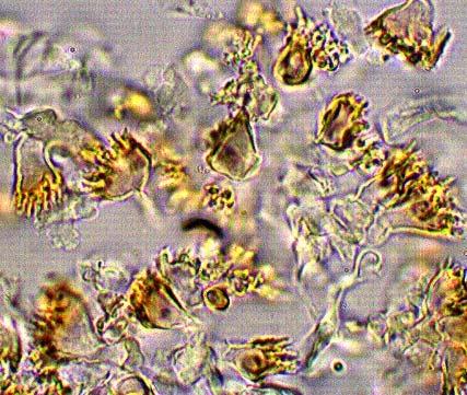 Basidios: 6 x 23 µm., esterigma <1µm, 2 esporas, inamiloides. Basidiolos: 4 x 35 µm.