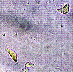 16-18 µm., con esterigma de 1 µm, 2 esporas, inamiloides.
