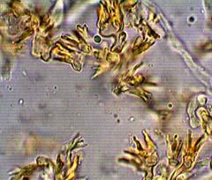 Microscópicamente basidiosporas subfusiformes, lisas, hialinas, la reacción inamiloide y células en escoba en la corteza.