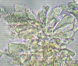 Basidios: no se observaron. Dermatocistidios: 4-5 x 17-21 µm., lanceolados de pared lisa, inamiloide. Corteza: tipo cutis. Hifas de la corteza: 4-5 µm., lisas, hialinas, con incrustaciones.