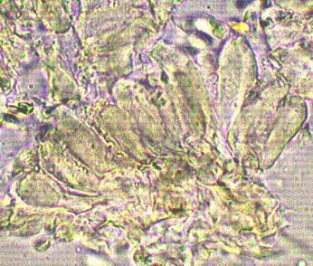 Características microscópicas: queilocistidios, basidiosporas ovaladas, lisas e inamilodes, reacción inamiloide. Este género no es formalmente aceptado.