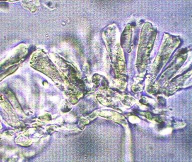 , hialinas en KOH, ovadas a amigdaliformes, pared lisa y delgada, 2 esporas, esterigma menor o igual a 1 µm.