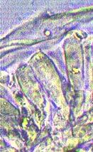 Basidios: 5 x 18 µm, con esterigma menor a 1 µm, 2 esporas, inamiloide. Cistidios: 5-6x15-28 µm. Corteza: tipo cutis. Subpelis: ausente. Trama: irregular. Hifas de la trama: 2.