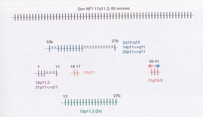 NF1 (pericentromérico C 1 7q11.