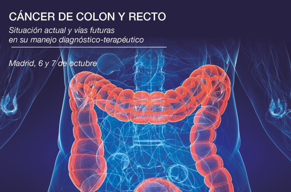 Cribado poblacional de cáncer de colon y recto: el modelo de Cataluña. Josep M. Augé Fradera jmauge@clinic.