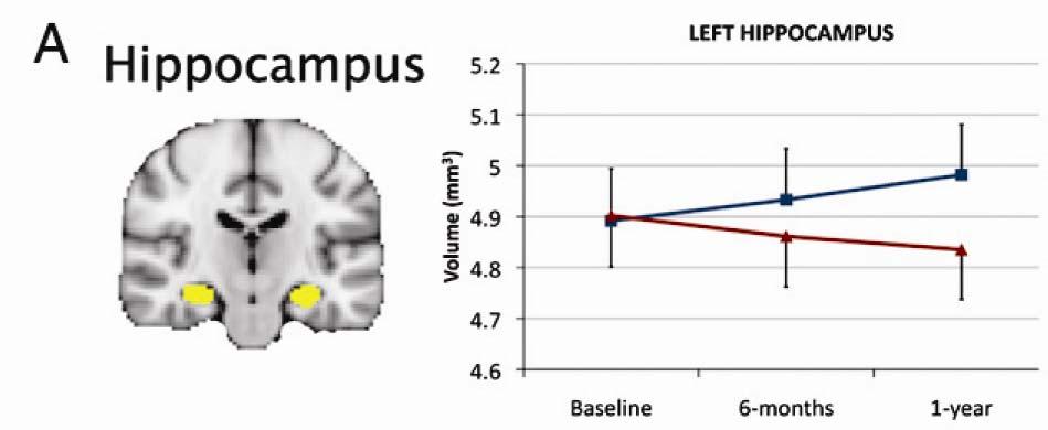 Envejecimiento, desempeño cognitivo y neurogénesis Estimación del volumen hipocampal por resonancia magnética ejercicio aeróbico