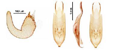En las patas protorácicas, mesotorácicas y metatorácicas la hembra presenta uncus o espina curva (Figura 4 C); en el macho el uncus de las patas metatorácicas esta bifurcado o dentado (Figura 4 D).