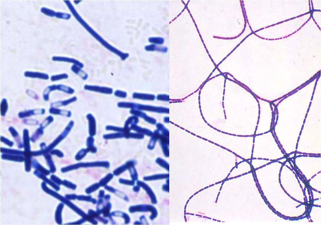 Bacilos, grampositivos grandes 1 x 3 8 μm, tendencia a formar cadenas, inmóvil, esporulado Cápsula proteica (poli D