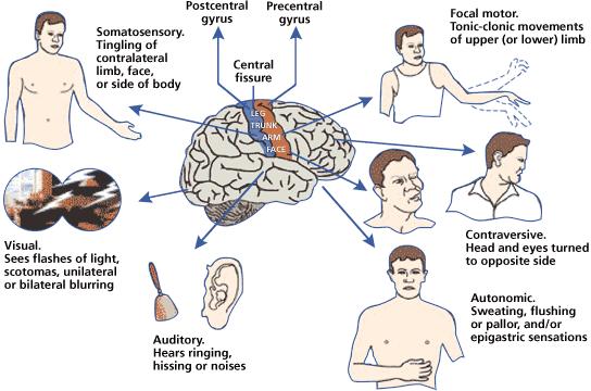 Crisis epilépticas focales Manifestaciones clínicas variables, relacionados con las funciones del área cortical donde se originan.