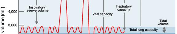 4. Conceptos básicos en ventilación Volumen corriente o tidal (VT) Frecuencia respiratoria (FR) Vl Volumen minuto,vt FR FiO2 Relación I/E.