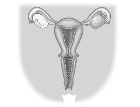 7 REFORÇ ATENCIÓ A LA DIVERSITAT 1 Retola els dibuixos dels aparells reproductors femení i masculí. 2 3 Respon les preguntes següents sobre els aparells reproductors masculí i femení.
