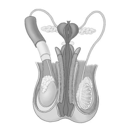 c) En quina part de l aparell reproductor femení es produeix la fecundació de l òvul? I la implantació de l embrió? Identifica les imatges següents i retola les parts indicades.