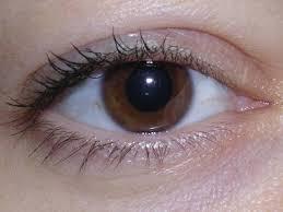 UVEITIS Inflamación del ojo en 1 de cada 5 niños con AIJ Niñas pequeñas Analítica con ANA POSITIVOS