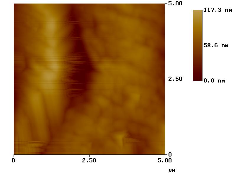 Esmalte Dental Dentina Figura 65 Imagen de AFM a una escala de 5 µm, de una pieza dental, mostrando la morfología de cada una de sus regiones [18