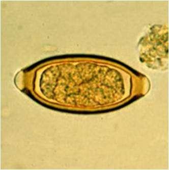 Formas evolutivas Son característicos y fáciles de identificar, aproximadamente miden 25 µm de ancho y 50µm