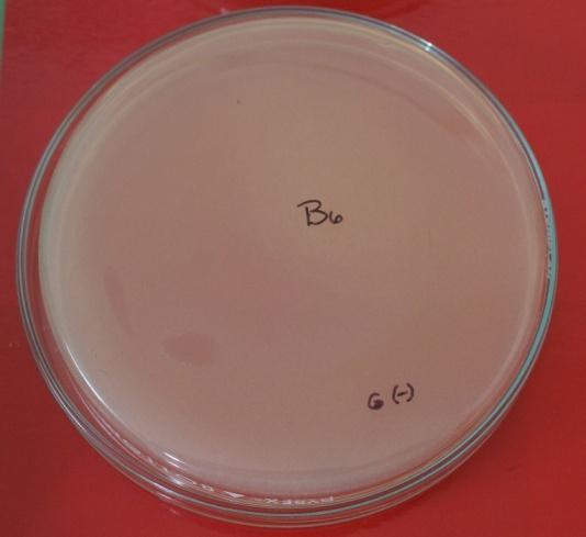 Figura. 4. bacteria B6 no inhibió a Escherichia coli Figura. 5. bacteria B6 inhibió a Figura. 6. bacteria B8 inhibió a Escherichia coli Figura. 7.