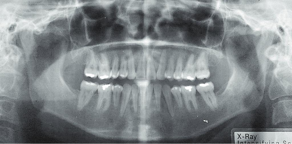 finales. Figura 8. Radiografía lateral inicial y final. Fuente: Dr.