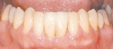 d) de la ortodoncia.