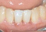 ortodoncia y después (c) del TMD: