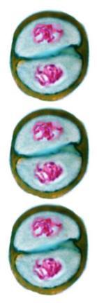 . Grupos isógeno axil: es el grupo de condrocitos que se disponen en forma columnar o en