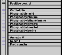 Antifosfolípidos Sindrome antifosfolípido con antifosfolipidos negativos