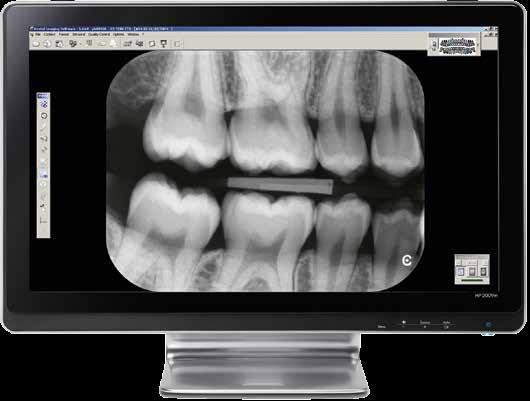 POTENTE SOFTWARE RADIOLÓGICO El software radiológico de Carestream Dental, utilizado de forma independiente o integrado en la