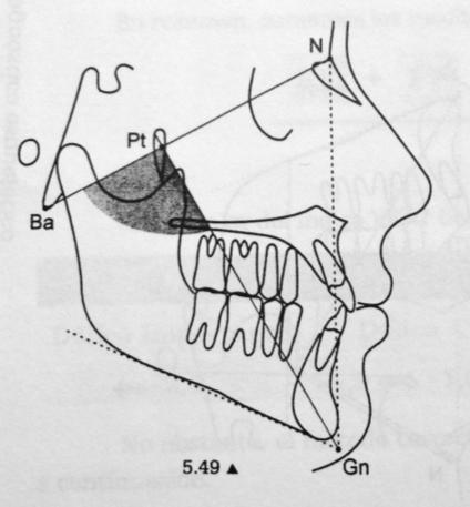 Fig. 10: Angulo del eje facial (Azenha, 2008) Profundidad Facial.