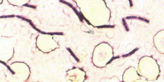 Espora de 1 µm, resistente a Tº, desecación y