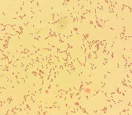 4 (izquierda) se puede evidenciar una gran presencia de bacterias Gram negativas (color rosa) y Gram positivas (color púrpura) con distintas formas como cocos, bacilos, y espirilos.
