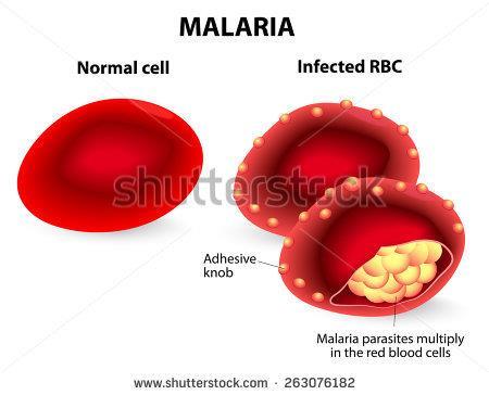 LA MALARIA Es una enfermedad infecciosa, la cual esta constituida en nuestro medio como un problema de salud pública.