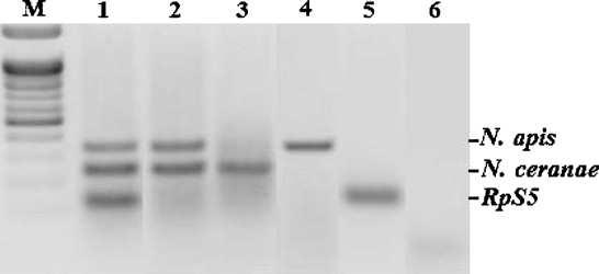 NOSEMOSIS: ANÁLISIS LABORATORIALES España ha decidido efectuar la diferenciación molecular por PCR entre