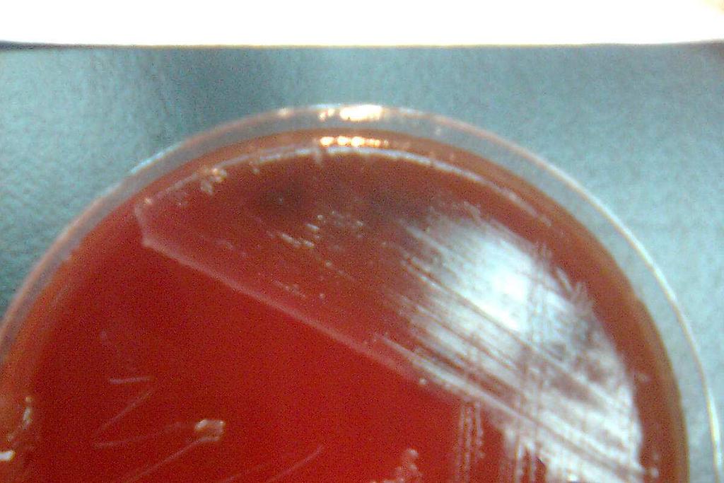 bacteriológicos (OIE)