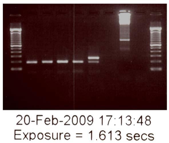 El análisis de Mycoplasma se realizó mediante PCR con Venor GeM-Mycoplasma Detection Kit, el cuál cumple con los prerrequisitos establecidos en la normativa Europea (párrafo 2.6.
