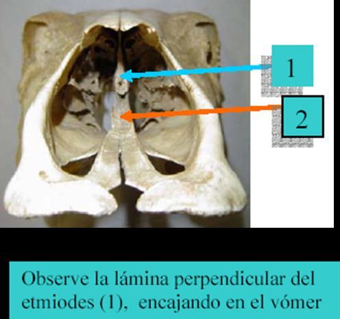 4. Esquindilesis: es una articulación en la cual un segmento óseo encaja en la hendidura de otro; Ejemplo: articulación entre la lámina perpendicular del hueso etmoides con el vómer. II.