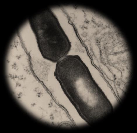 Adherencia de Listeria persistente Las cepas de L. monocytogenes persistentes tienen mayor capacidad de adherencia a las superficies de acero inoxidable que las no persistentes.
