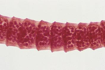 Hymenolepis nana: AGENTE