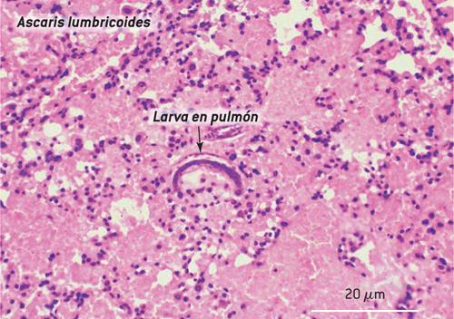 Ascaris lumbricoides: PATOGENIA