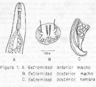 CASOS CLÍNICOS 185 Macho (Fig. 1 A y B). Tiene una longitud promedia de 20 mm. En la base del esófago su anchura es de 0.112 a 0.14 mm. y su máxima anchura alcanza a 0.28 a 0.31 mm.