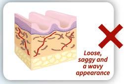 2 Estira y reafirma: El colágeno y la elastina componen los tejidos más importantes que proporcionan elasticidad a la piel.