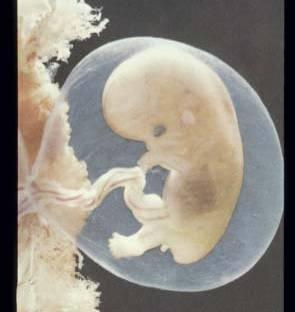el feto -Depende de la etapa de gestación y de la dosis