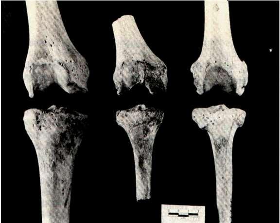gorila 5 6 rodilla humana rodilla de